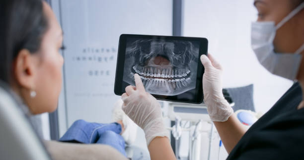 Licensed Root Canal Treatment service in Stockton University, NJ - Smile Center Dentistry